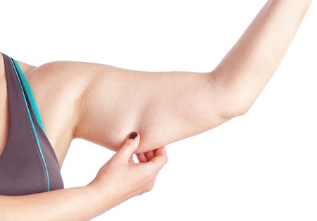 Flabby Arm